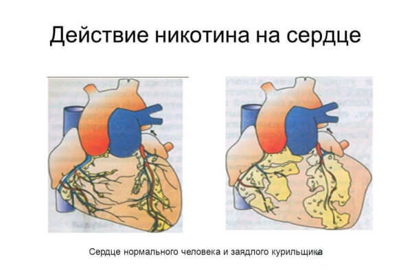 Как курение влияет на сердце?
