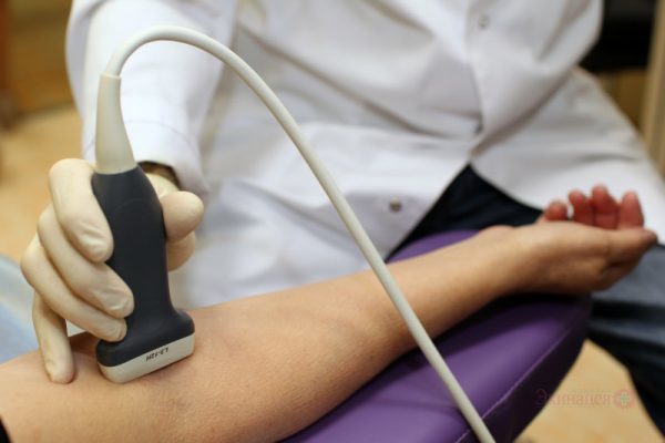 Выступают вены на руках у женщин и мужчин: причины, лечение сильно выпирающих вен