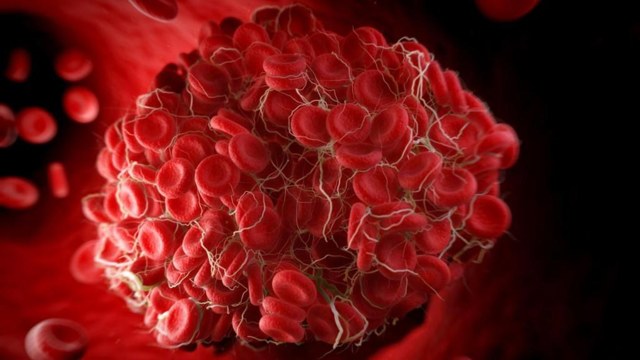 Какие продукты разжижают кровь и нормализуют кровообращение