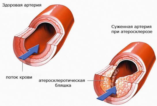 Верхнее давление высокое нижнее в норме