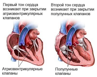 Тоны сердца приглушены что это значит - Лечение гипертонии