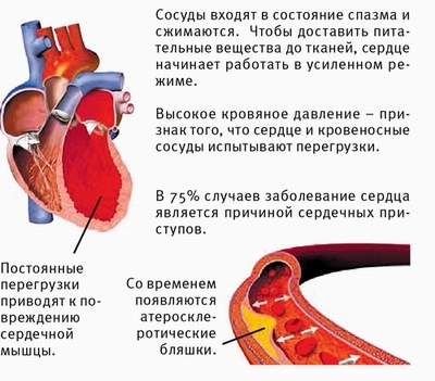 При расширении сосудов давление повышается или понижается? - БолезнейНет