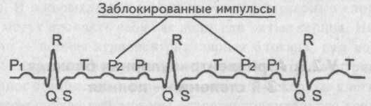 Атриовентрикулярная проводимость Википедия
