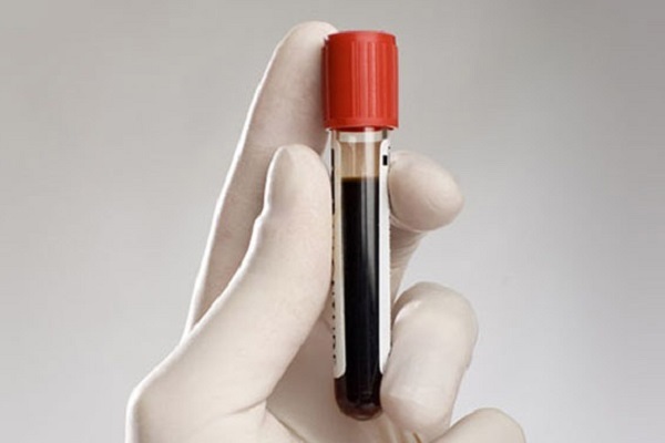 Первая отрицательная группа крови у мужчин и женщин