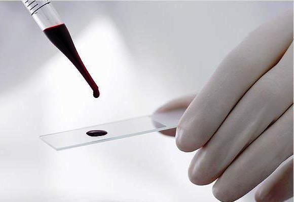 Гормон ФСГ в крови - Повышенный гормон ФСГ у женщин в лаборатории Lab4U