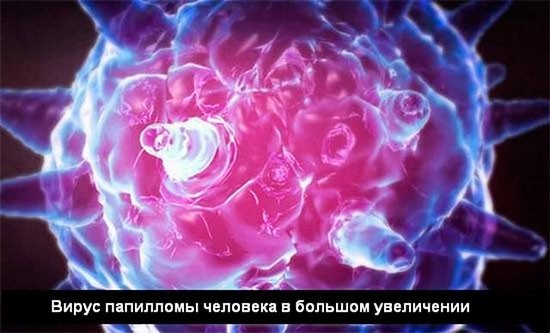 Что такое бородавка и как с ней бороться?