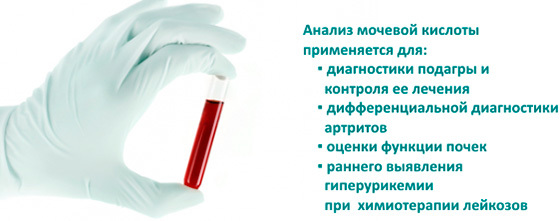 Мочевая кислота в крови норма у мужчин и женщин по возрасту, таблица, симптомы и лечение, если повышена, понижена, народными средствами, препаратами