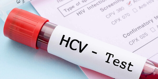 Вирус гепатита С (Hepatitis C Virus), качественное суммарное определение антител, ИФА (anti-HCV, кач.)