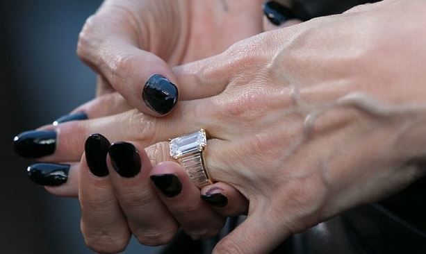 Варикоз на руках: симптомы, может, может ли быть, варикозное расширение вен, лечение, причины, верхних конечностей