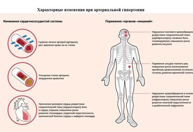 Головная боль в затылке: причины и лечение