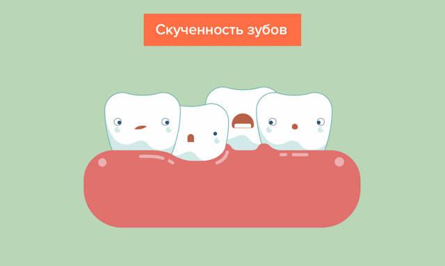 Прорезывание зубов у детей: сроки, порядок, симптомы