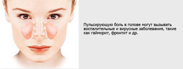 Головная боль в области лба и висков - что делать?