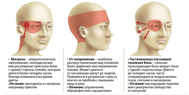 Пульсирующая боль в висках: главные причины и лечение