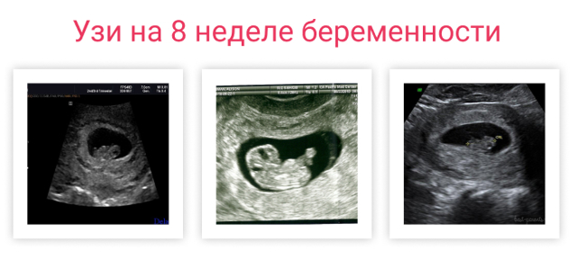 Развитие плода на 8 неделе беременности (17 фото): что происходит с малышом, размеры ребенка и ощущения, как выглядит малыш на 8 акушерской неделе