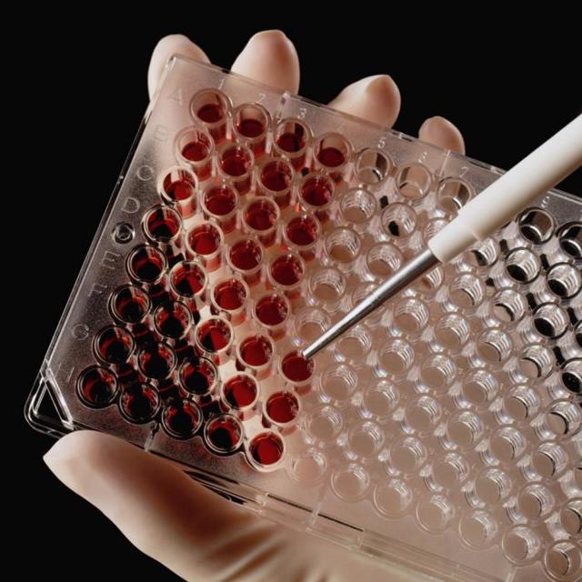 Роэ в крови норма у мужчин по возрасту таблица - Все про гипертонию