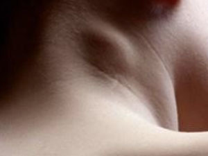 Воспаление лимфоузлов на шее - симптомы, причины и методы лечения