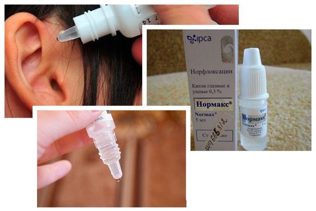 Нормакс - 5 отзывов, цена от 60 руб., инструкция по применению