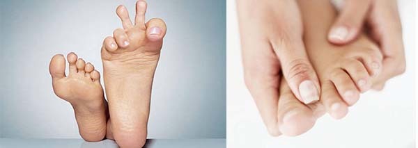 Отек ног в области стопы: причины припухлости правой и левой ступни, что делать, почему отекают ноги у женщин