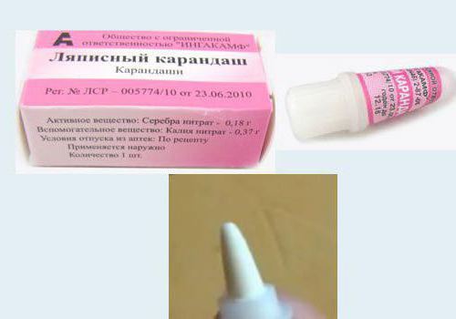 Ляписный карандаш от папиллом, инструкция по применению и отзывы