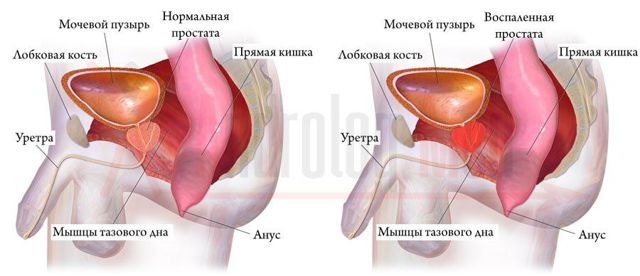ПРОСТАМОЛ УНО - инструкция по применению, цена и отзывы