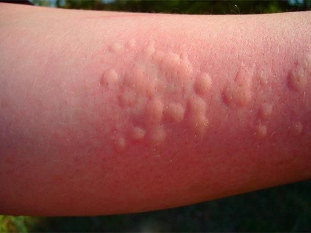 Инструкция по применению мази Преднизолон - показания