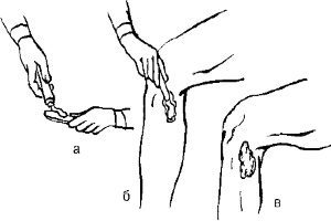 Инструкция по применению мази Преднизолон - показания