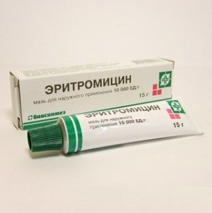 Капли от конъюнктивита для детей: при вирусной, бактериальной и аллергической форме