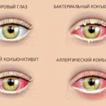 Зиртек - 33 отзыва, цена от 161 руб., инструкция по применению