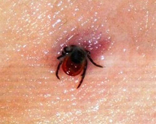 Какие последствия может иметь укус клеща у человека