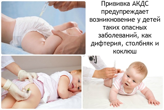Коклюш у детей: симптомы и лечение