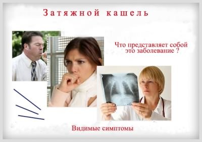 Не проходит кашель у взрослого причины