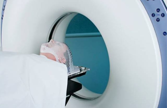 Основные симптомы аневризмы сосудов головного мозга