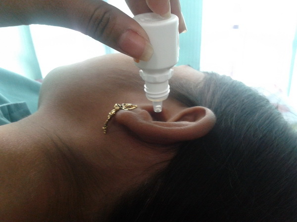 Отит среднего уха: симптомы и лечение у взрослых в домашних условиях