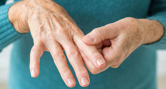 Артрит - симптомы, причины, лечение заболевания