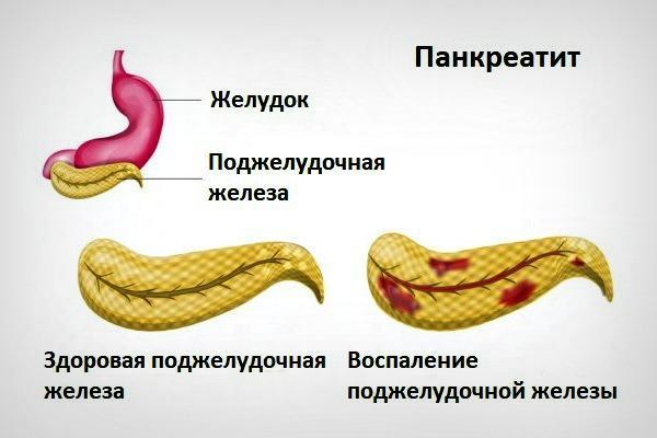 Желтые белки глаз: причины симптомы и лечение