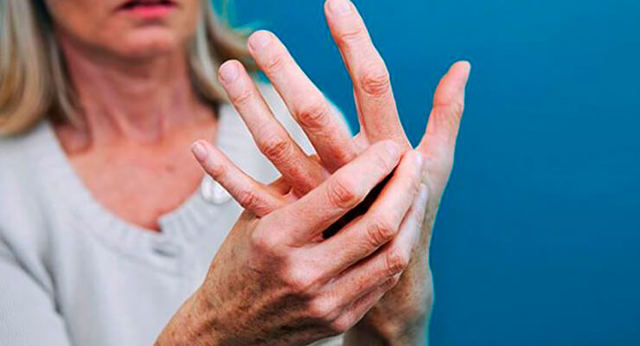 Артрит - симптомы, причины, лечение заболевания