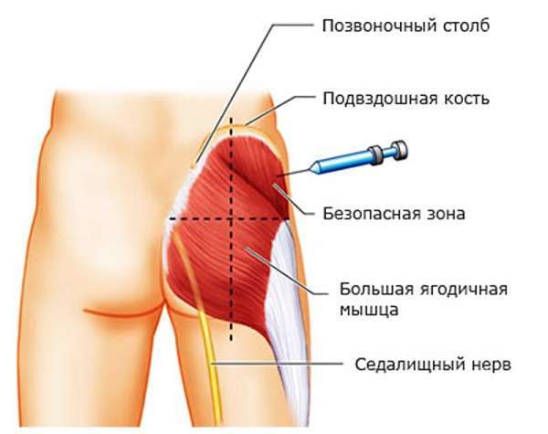 Уколы Глюконат кальция: применение, отзывы о препарате