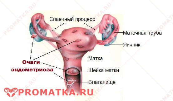 ЖАНИН: ИНСТРУКЦИЯ ПО ПРИМЕНЕНИЮ, ЦЕНА, ОТЗЫВЫ, АНАЛОГИ. ТАБЛЕТКИ ЖАНИН ПРИ ЭНДОМЕТРИОЗЕ ОТЗЫВЫ ВРАЧЕЙ, ПЛЮСЫ И МИНУСЫ