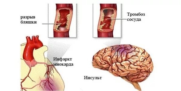 Пульсирующая боль в висках: главные причины и лечение