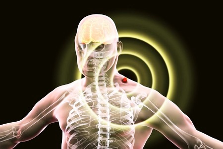 Клещевой энцефалит: диагностика, симптомы и лечение заболевания