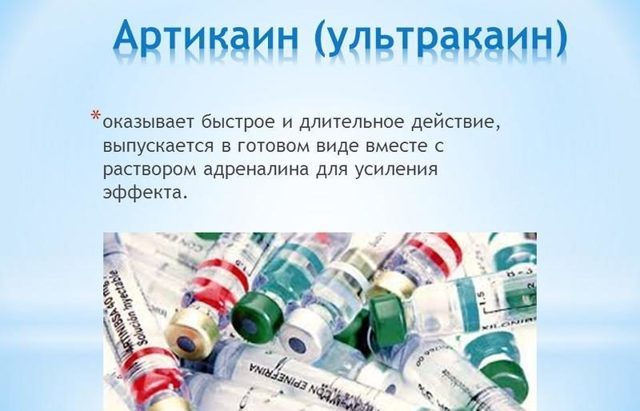 Ультракаин цена в Томске от 5371 руб., купить Ультракаин, отзывы и инструкция по применению