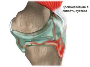 Витрум кардио омега-3 по выгодной цене Витрум кардио омега-3 купить в Нижнем Новгороде, инструкция по применению, аналоги, отзывы