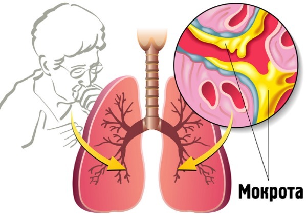 Гербион от сухого кашля: инструкция по применению, сироп от влажного кашля