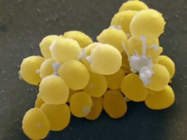 Баланопостит у ребенка: симптомы и лечение недуга