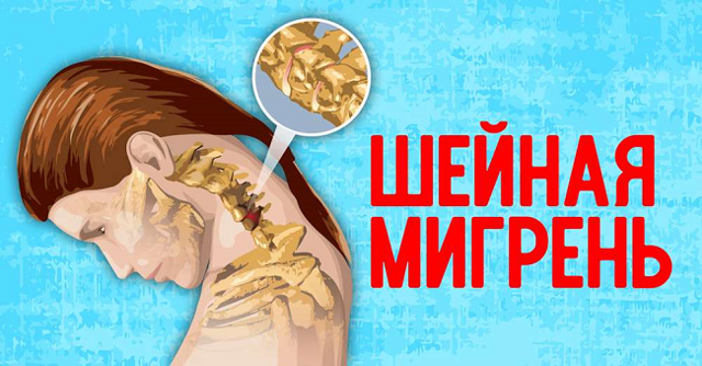 Головная боль в затылке: причины и лечение