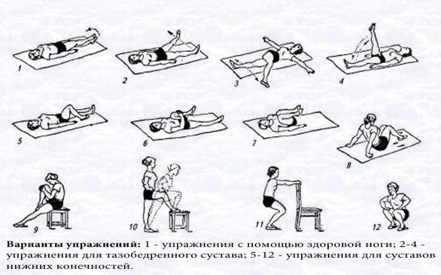 Перелом шейки бедра у пожилых людей - операция, сроки лечения