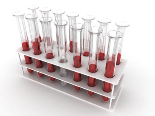 Роэ в крови норма у мужчин по возрасту таблица - Все про гипертонию