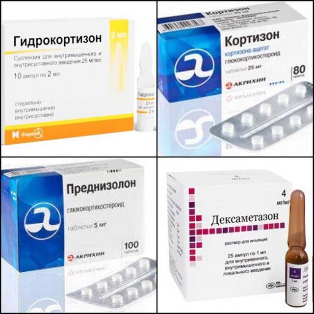 Ревматизм суставов - симптомы и лечение