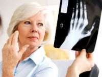 Метотрексат при ревматоидном артрите — Суставы