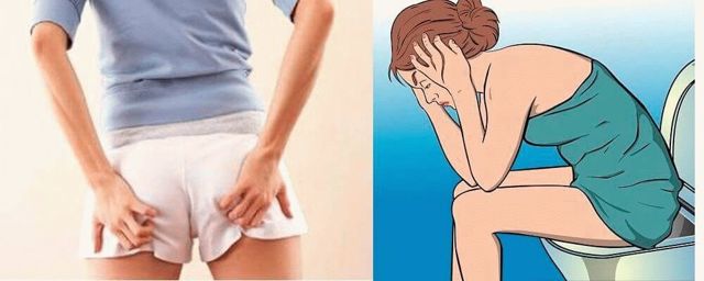 Сильно кровит геморрой и кровоточит узел: что делать